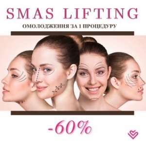    !      Smas lifting -  1