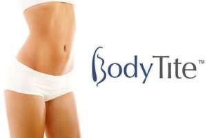        BodyTite -  1