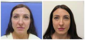 ���� ������� - ����������� 1