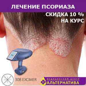 ������� �������� - ����������� 1