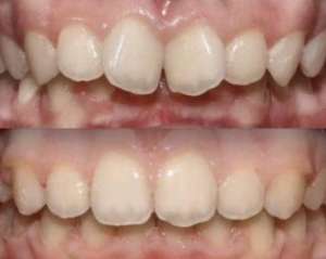 �������, ��������, �������� ���� - ����������� 1