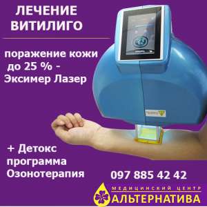 �������� - ����������� 1