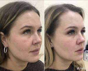 ��������� ������ �� ������� - ����������� 1