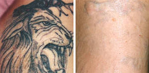 ��������� ���������� ����������� ���� ������ �� 200 ��� - ����������� 1