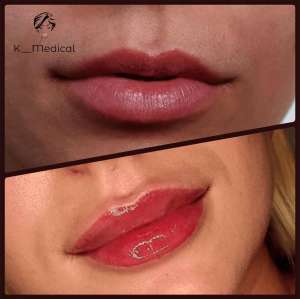 ���������� ���� - ����������� 1