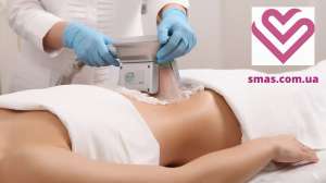 ����������� ���������� ��� �� ������ ����� � ������� - ����������� 1