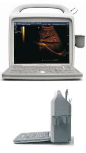 ����������� ������������ ������� ��� iuStar 160 (B/W) - ����������� 1