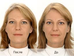 ������������ ������� 100% - ����������� 1