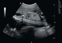 ������������� ������� Logiq C5 Premium - ����������� 1