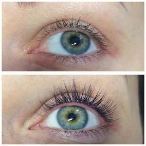 �������������� ����� ��������, ���������� - ����������� 1